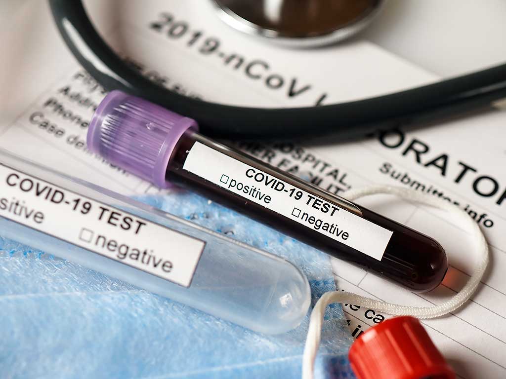 campagne di vaccinazioni